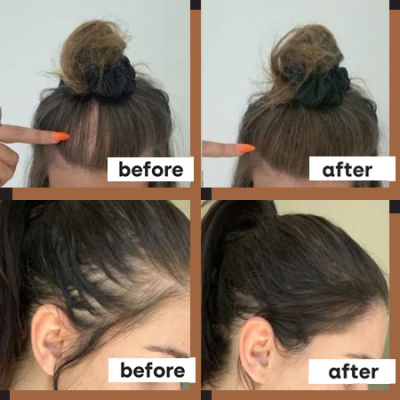 before and 111psd copy